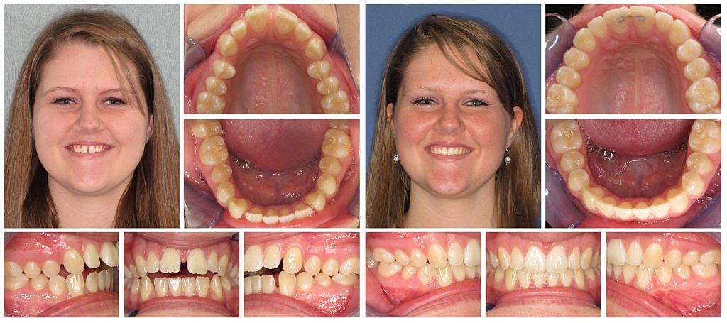 Reimagine Your Smile: Dr. George Harouni’s Invisalign and Cosmetic Dentistry Magic!