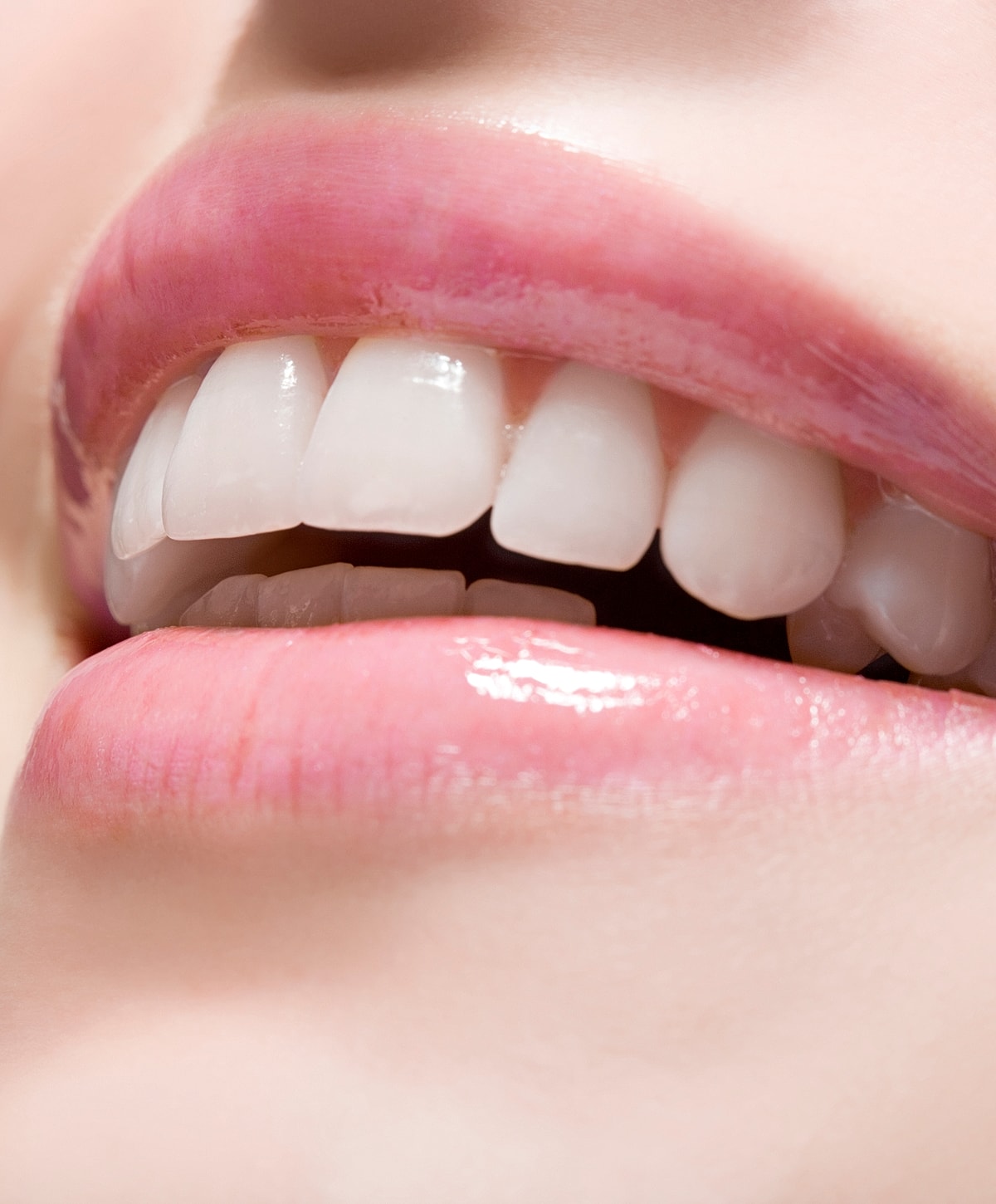 Close-up of smiling lips and white teeth.