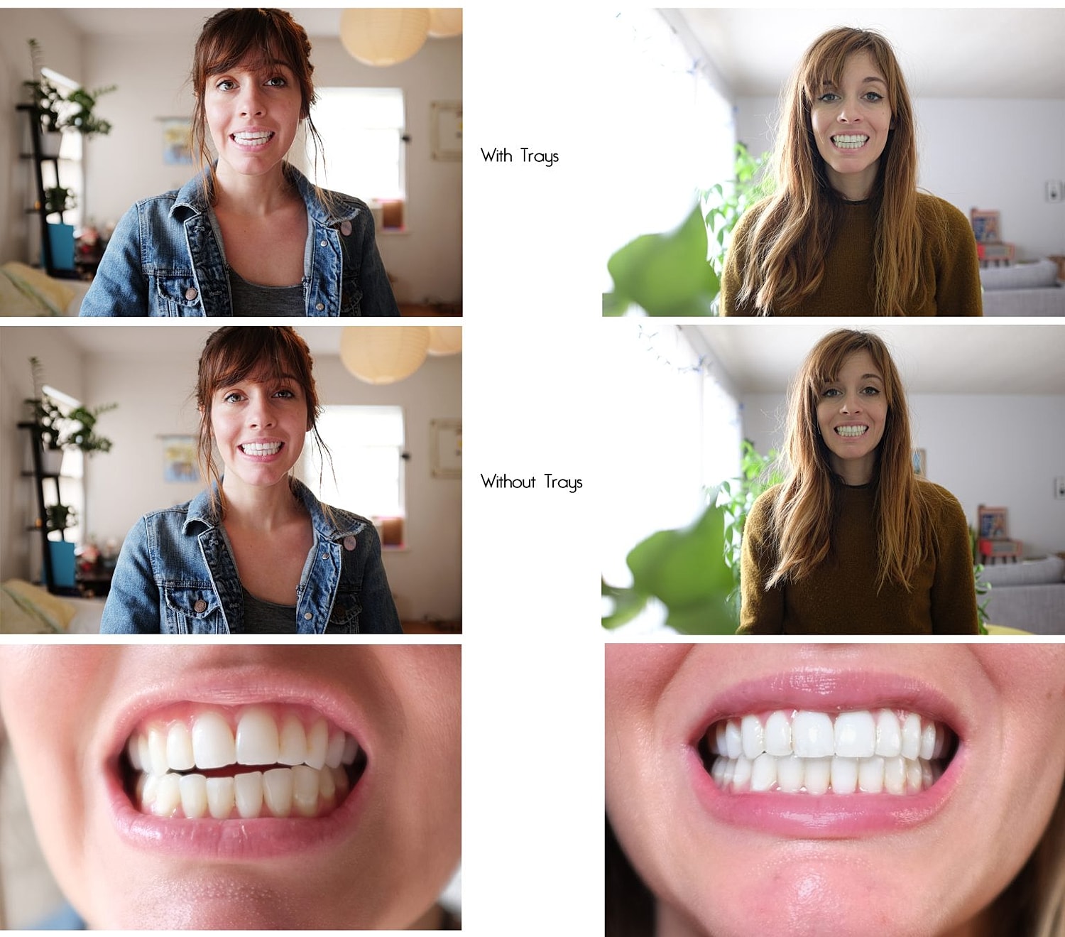 Comparison of smiles with and without trays.