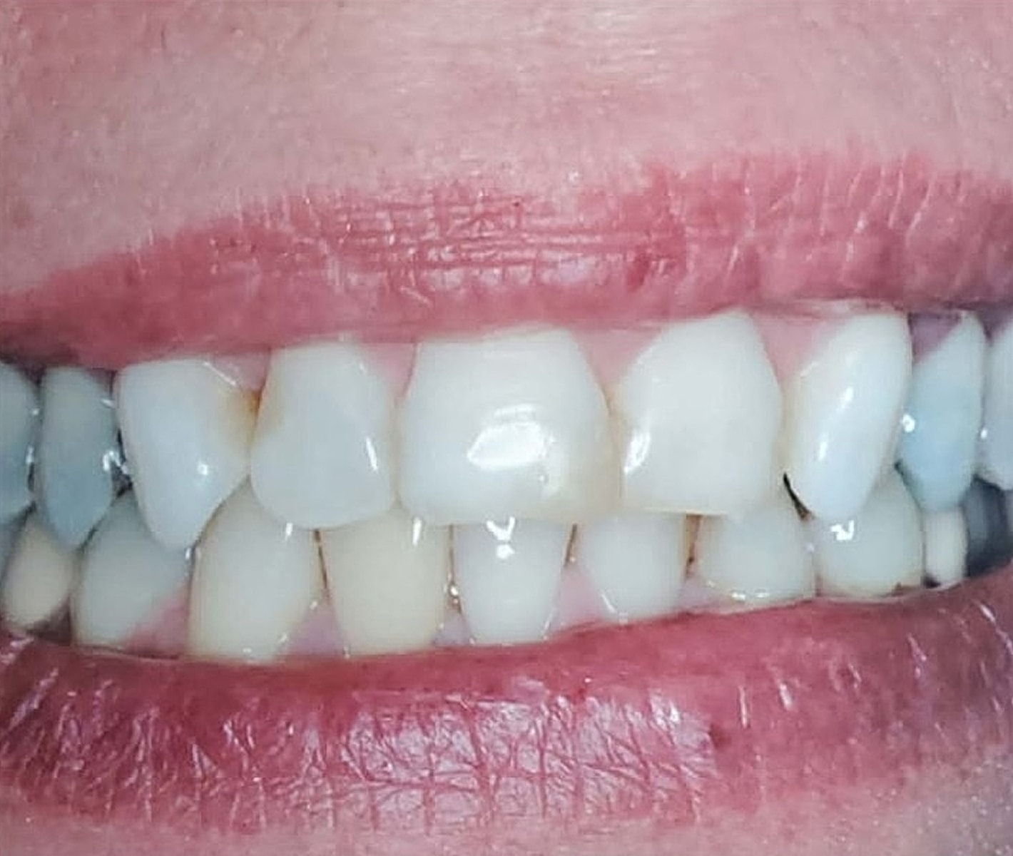 Before & Afters Before & After
