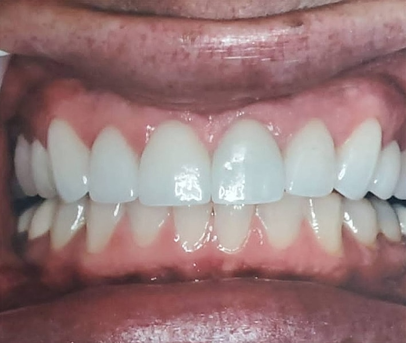 Before & Afters Before & After