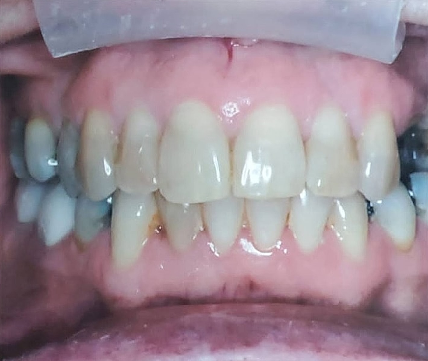 Before & Afters Before & After