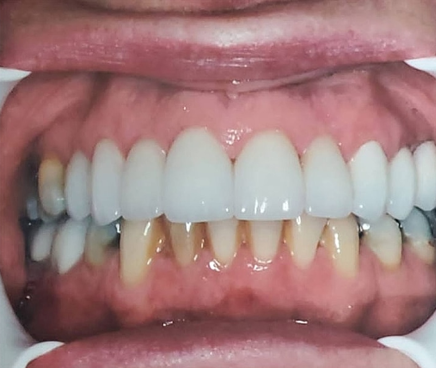 Before & Afters Before & After