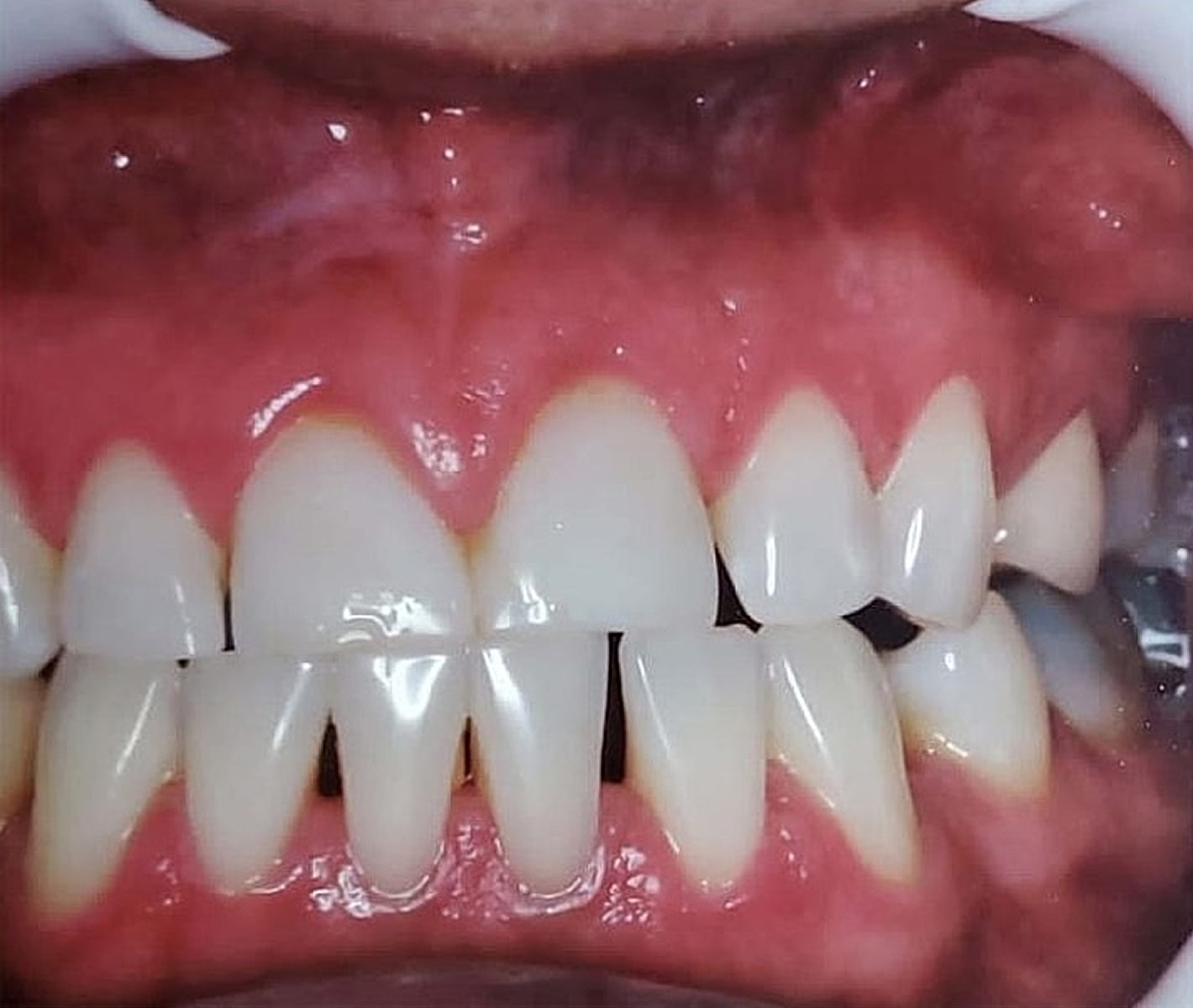 Before & Afters Before & After