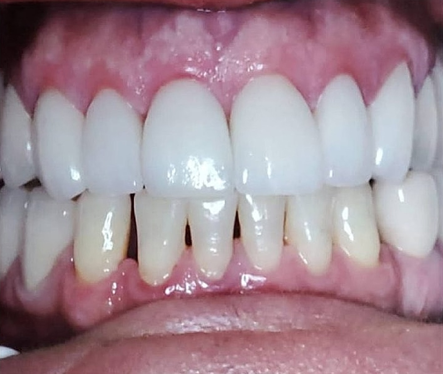 Before & Afters Before & After