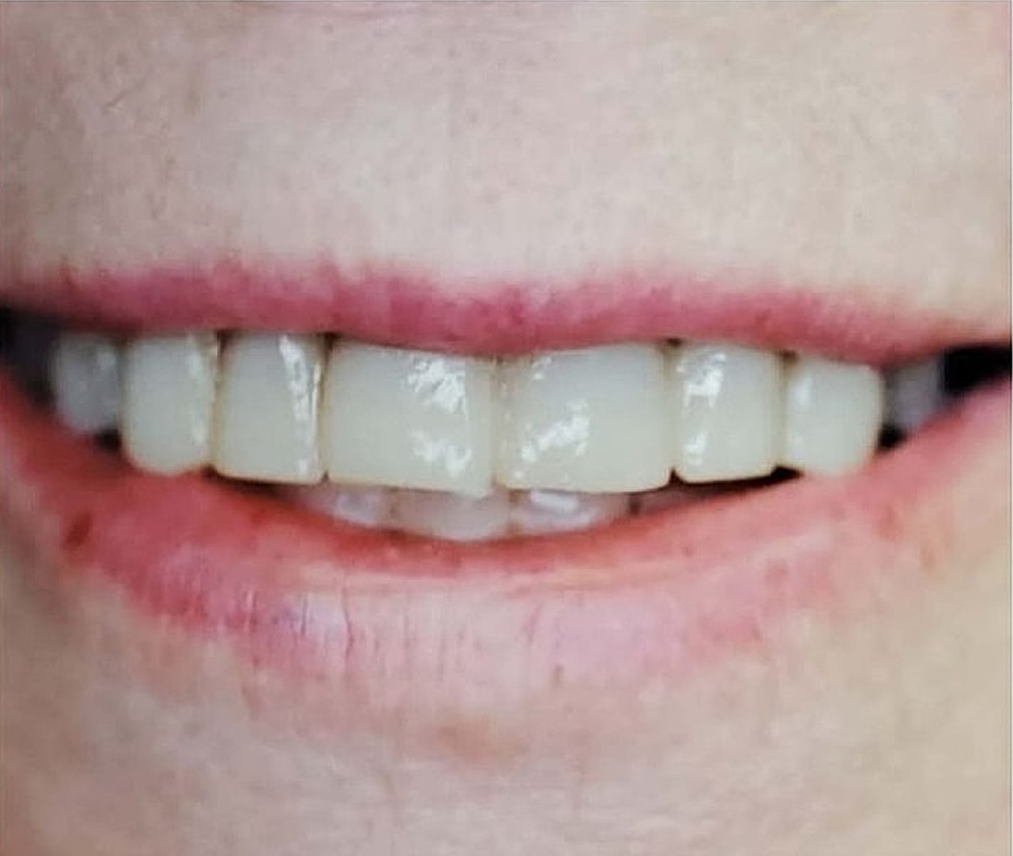 Before & Afters Before & After