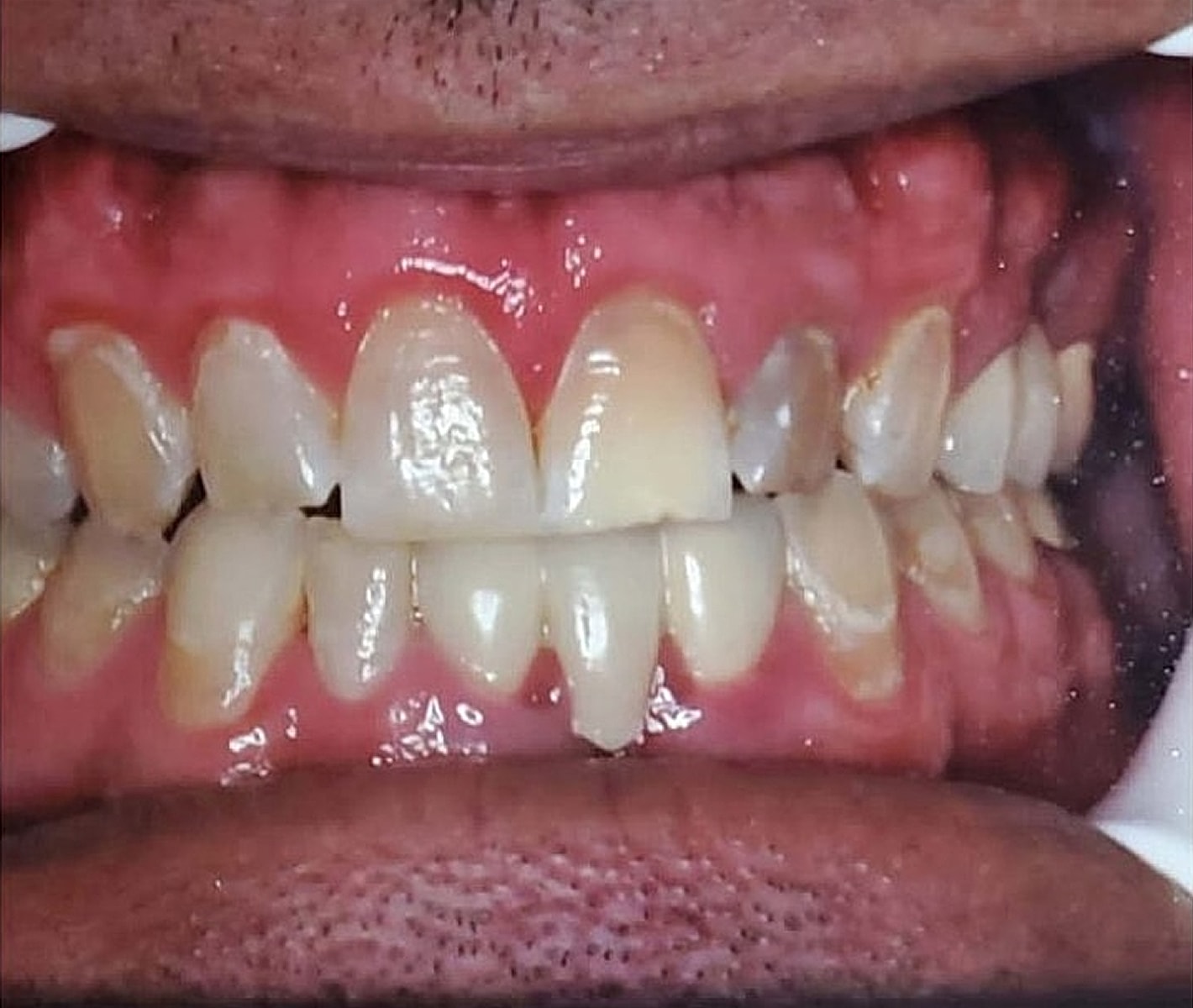 Before & Afters Before & After