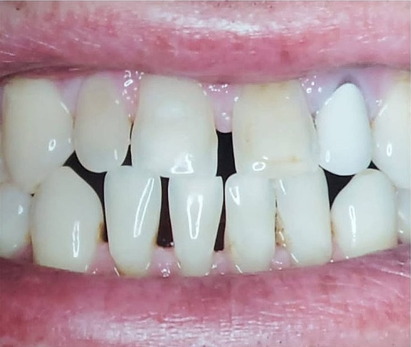 Before & Afters Before & After