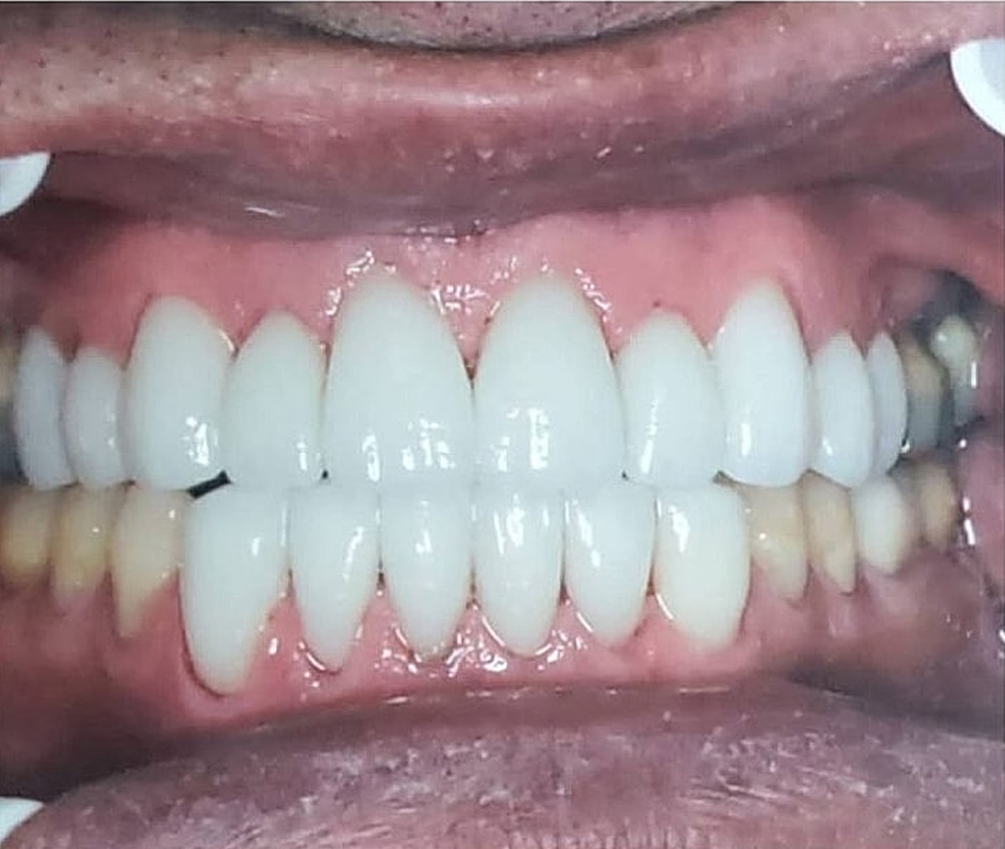 Before & Afters Before & After