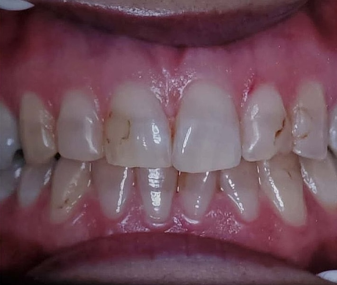 Before & Afters Before & After