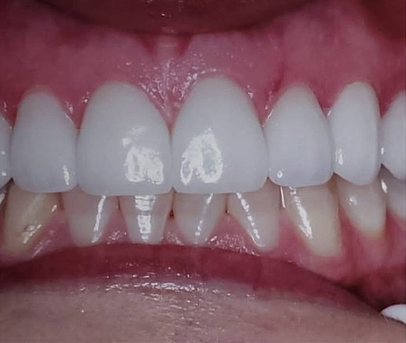 Before & Afters Before & After
