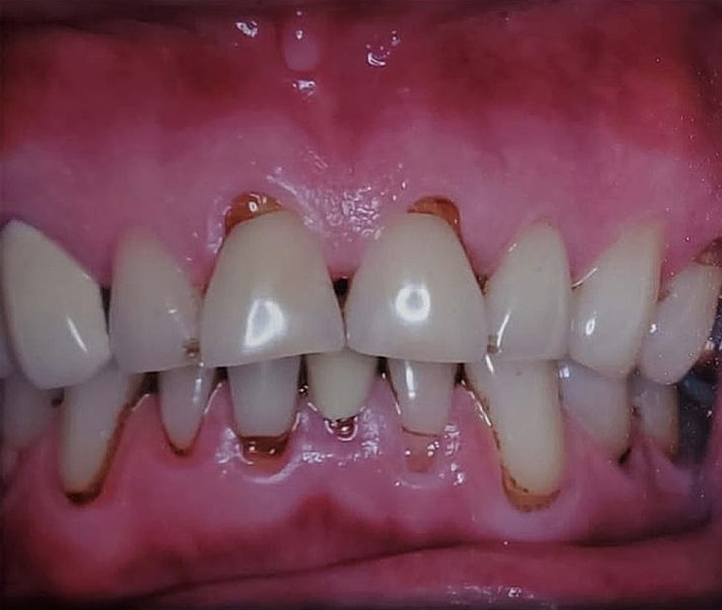 Before & Afters Before & After
