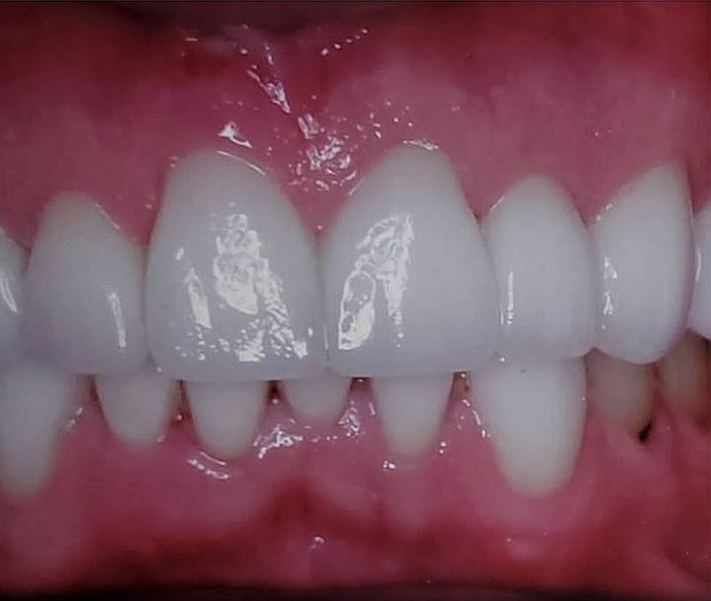 Before & Afters Before & After