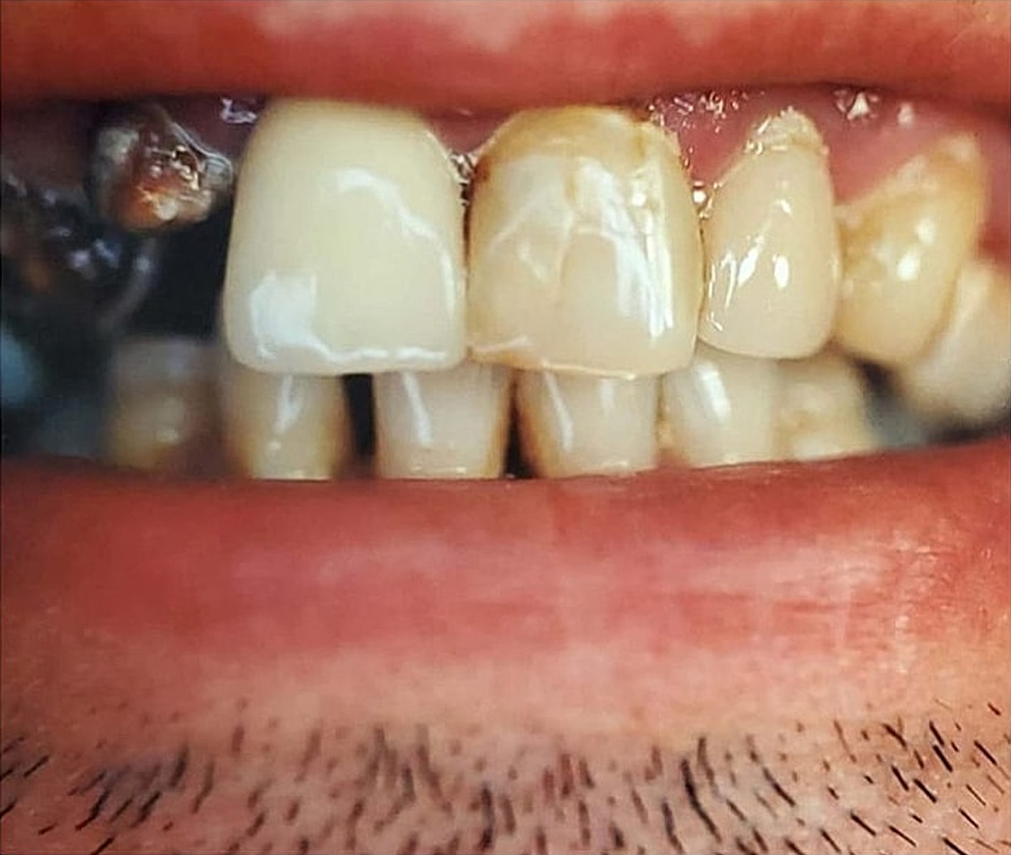 Before & Afters Before & After