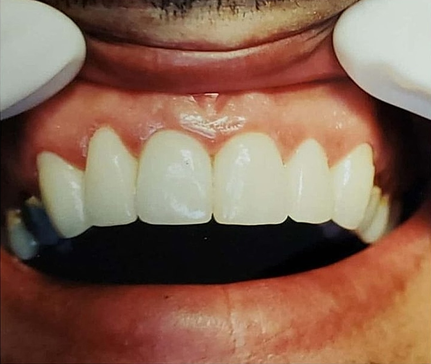 Before & Afters Before & After