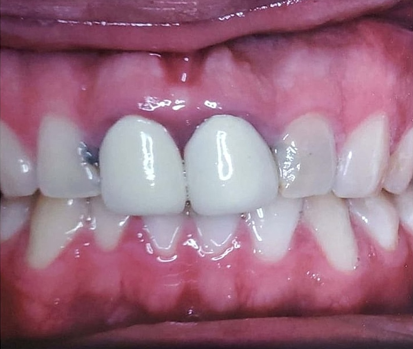 Before & Afters Before & After