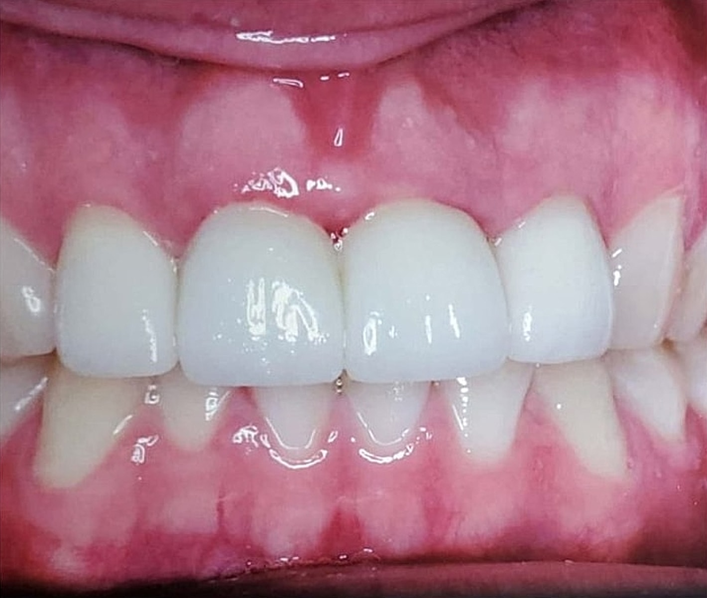 Before & Afters Before & After