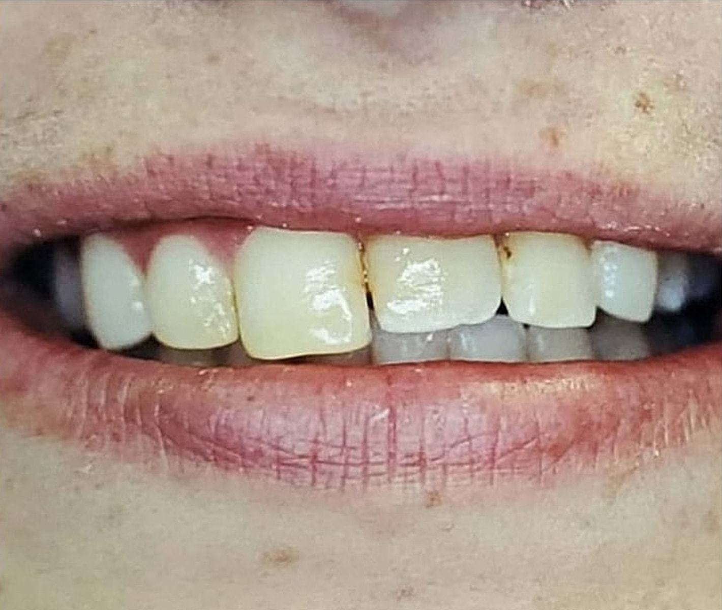 Before & Afters Before & After