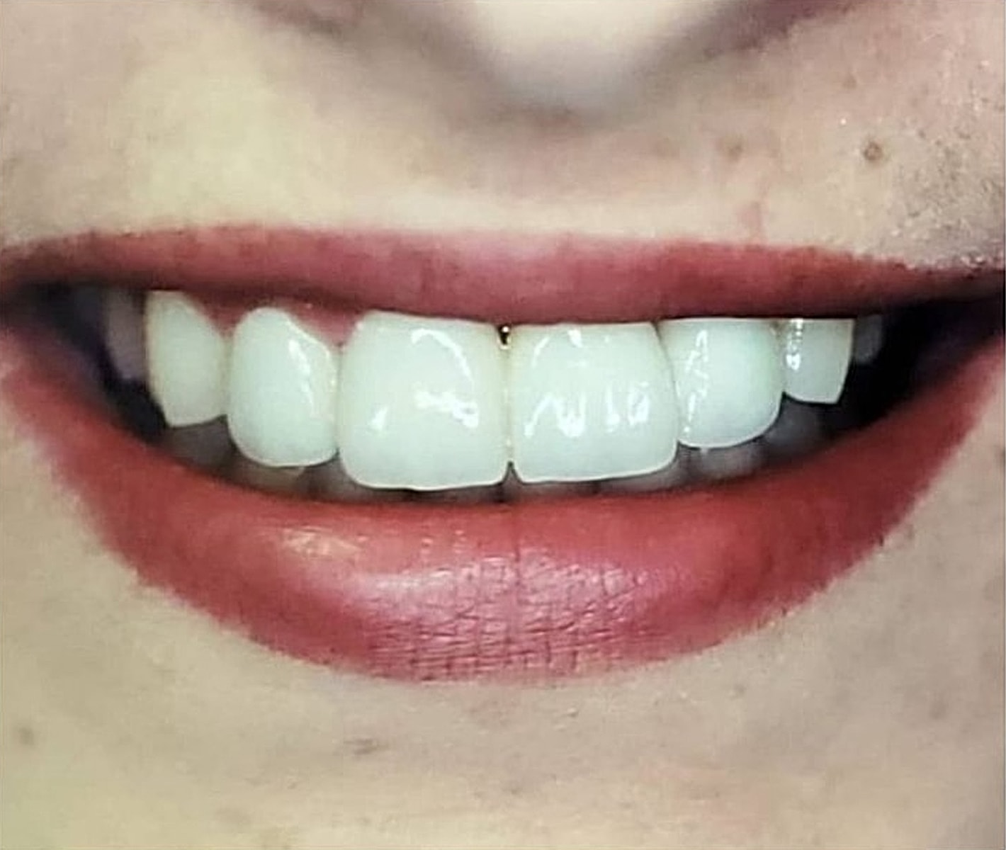 Before & Afters Before & After