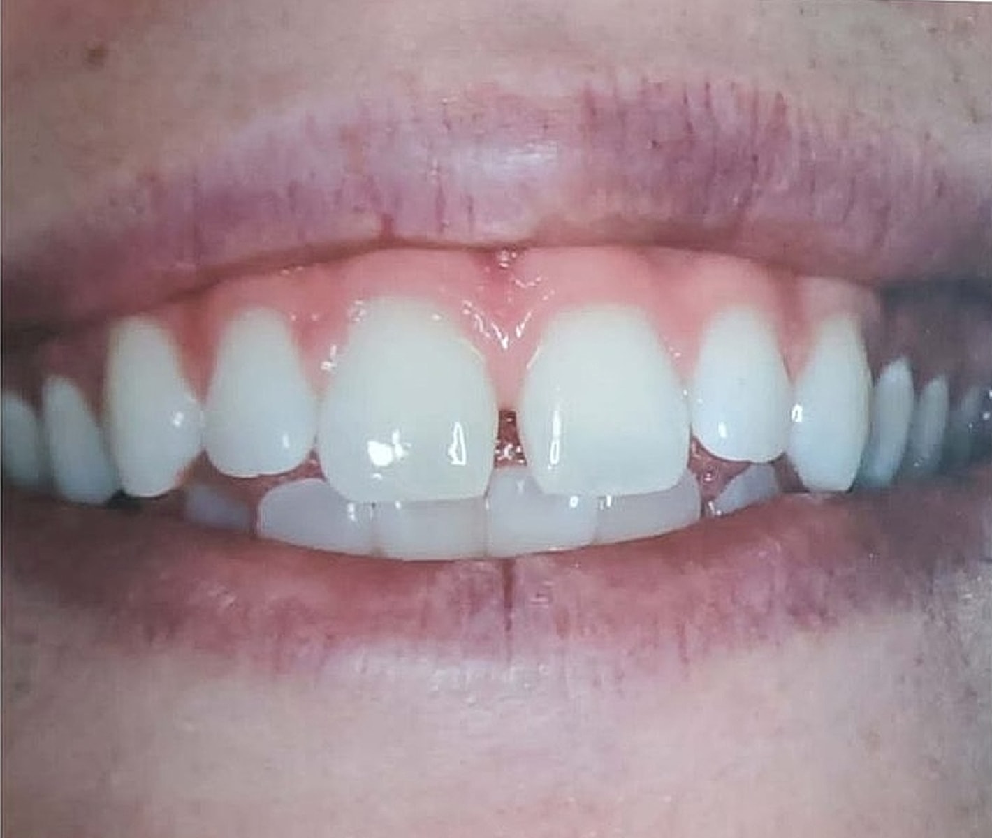 Before & Afters Before & After
