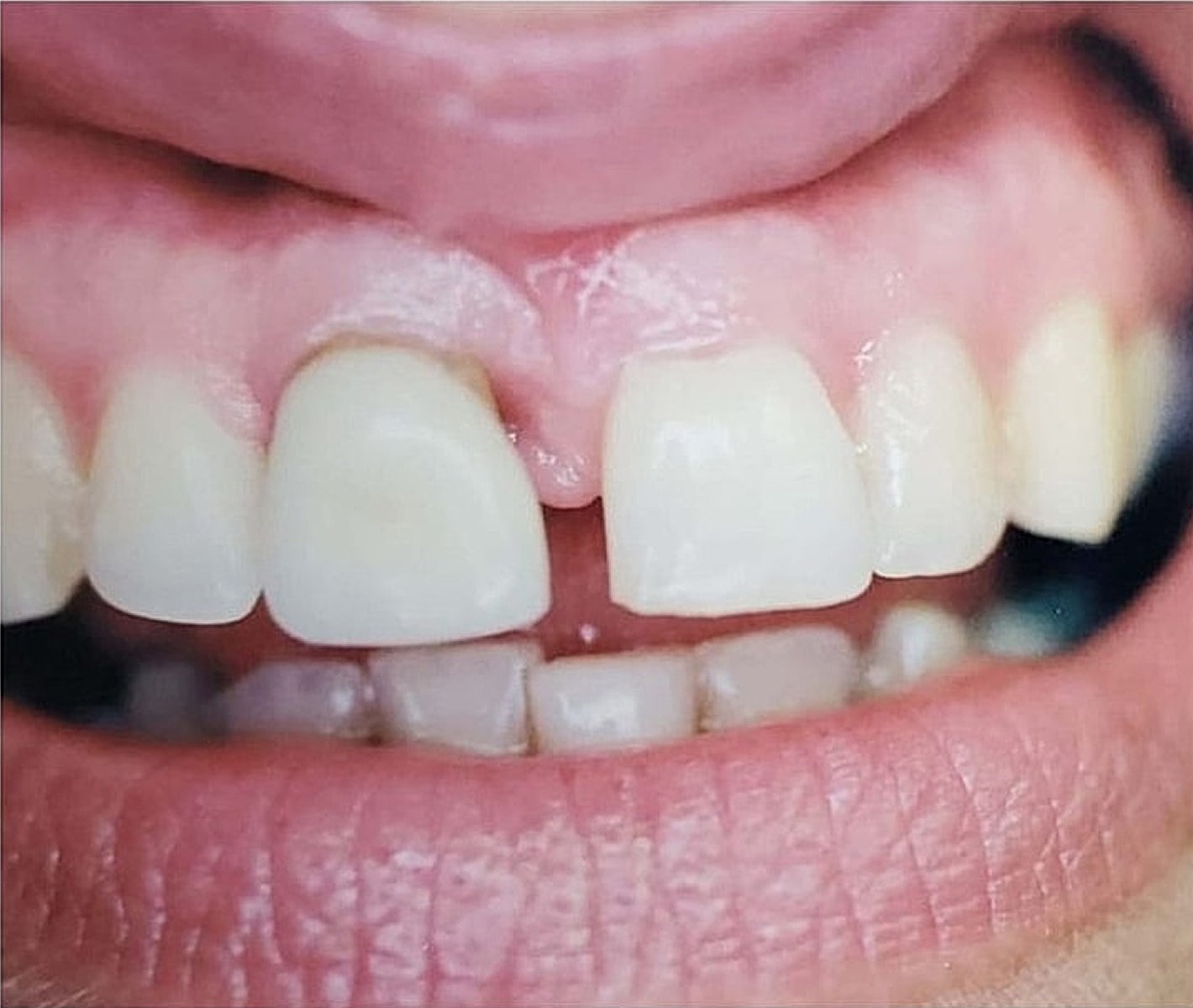 Before & Afters Before & After