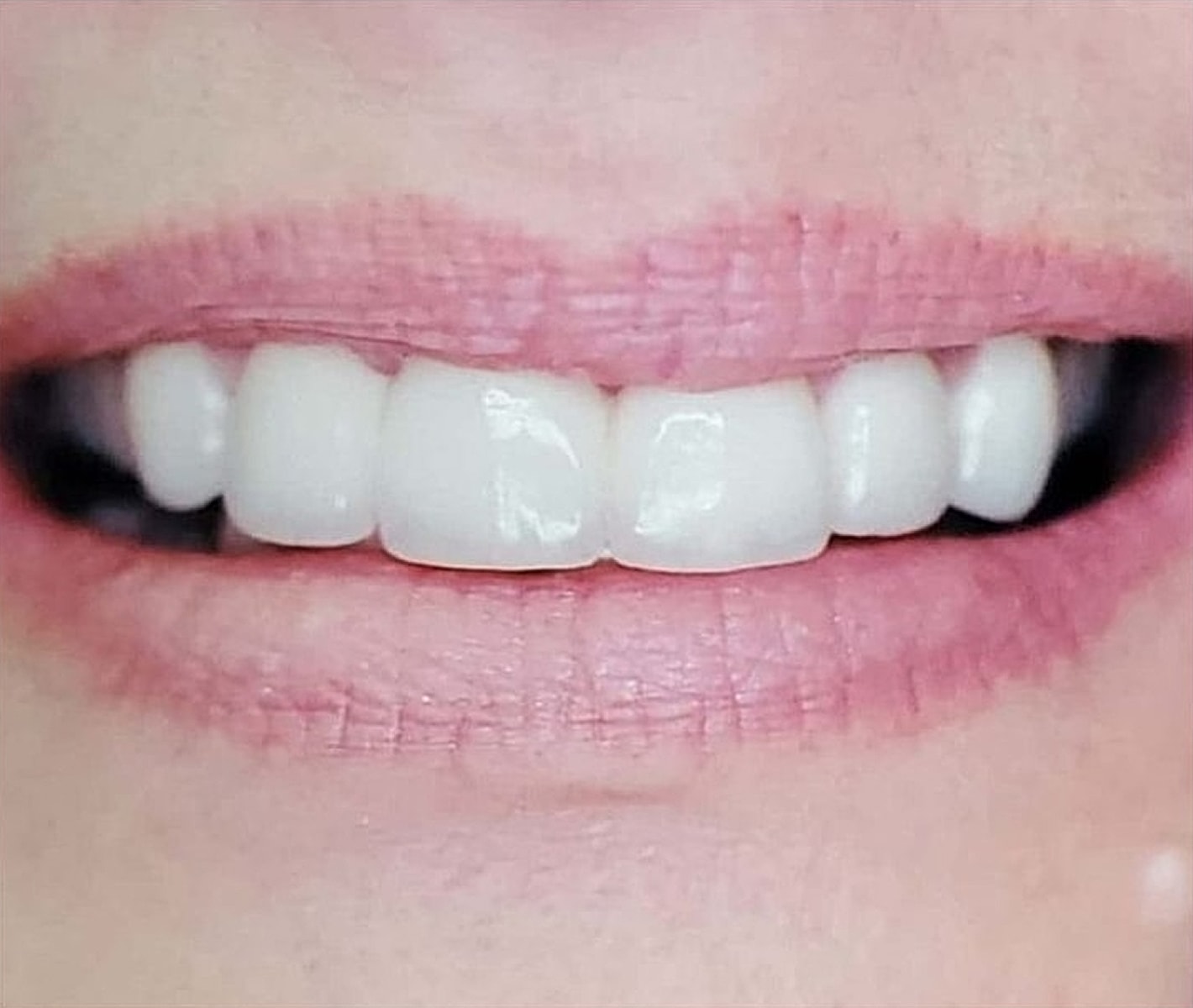 Before & Afters Before & After