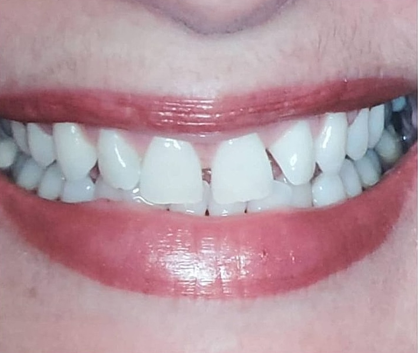 Before & Afters Before & After