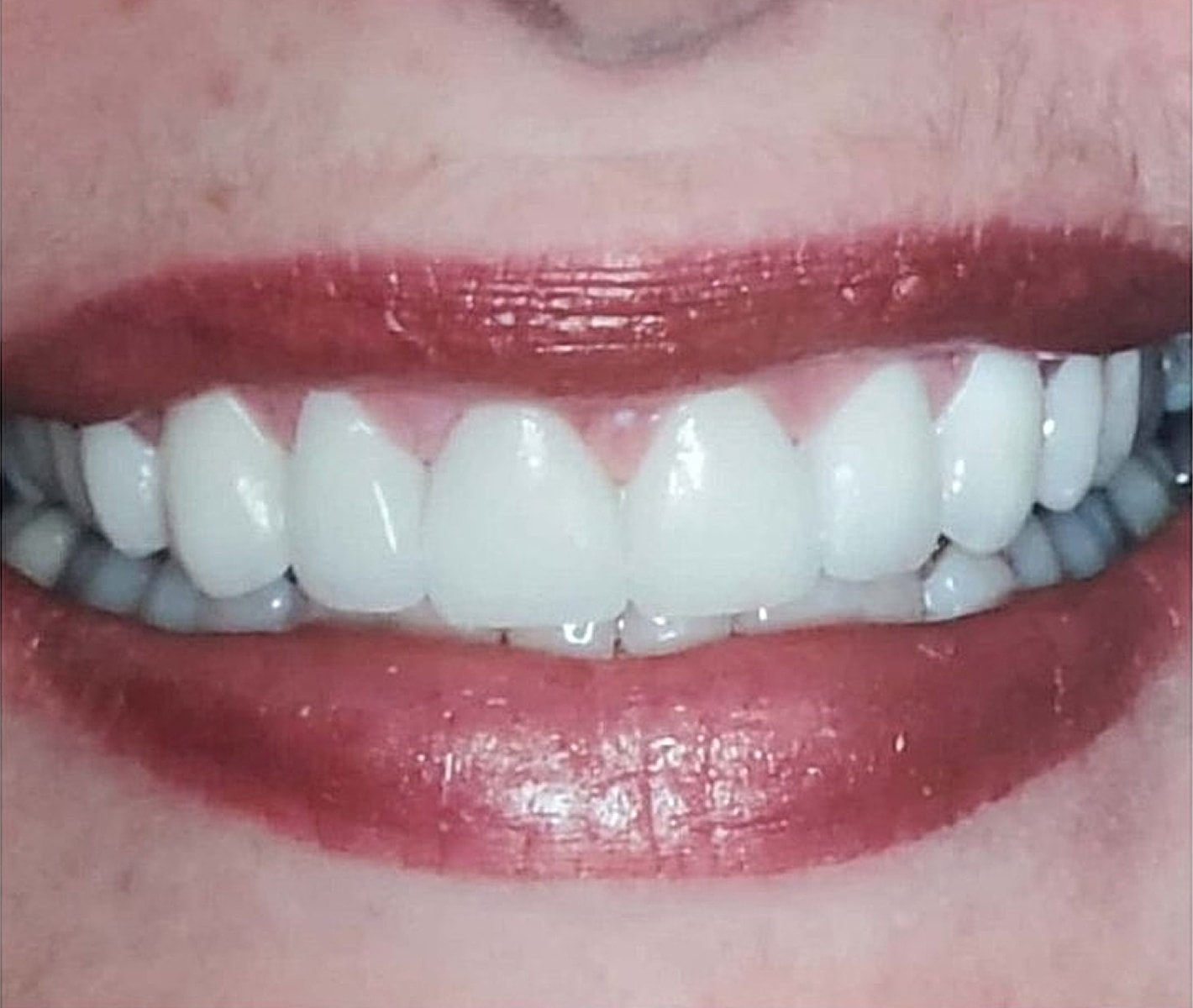 Before & Afters Before & After