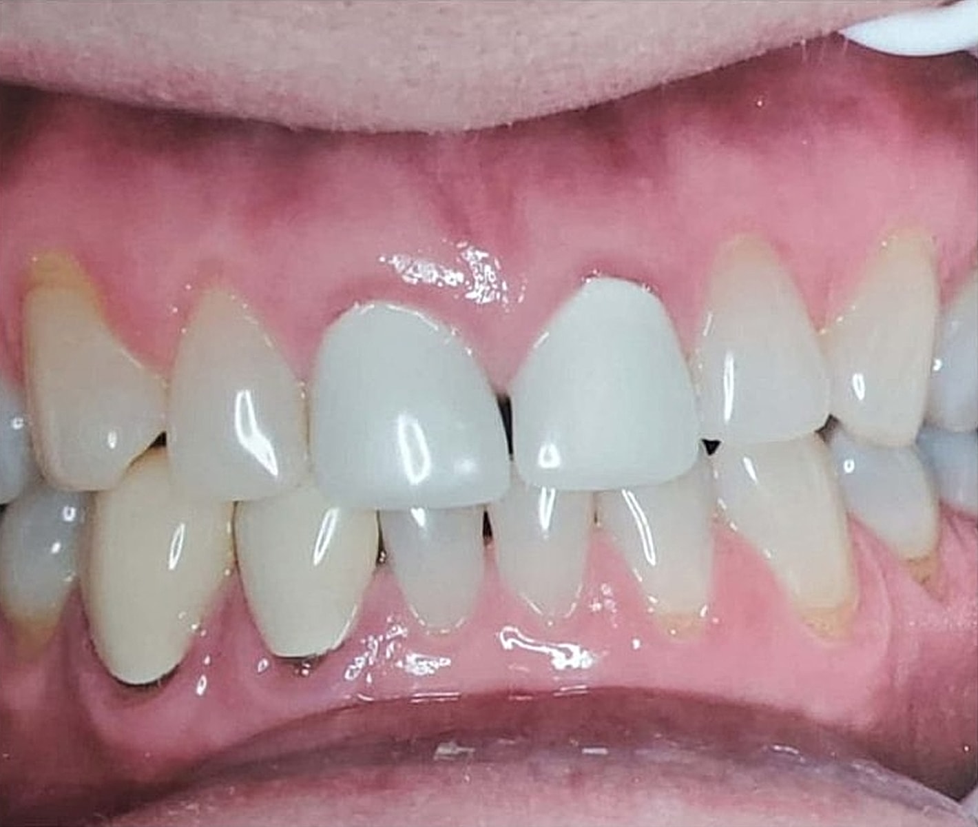Before & Afters Before & After