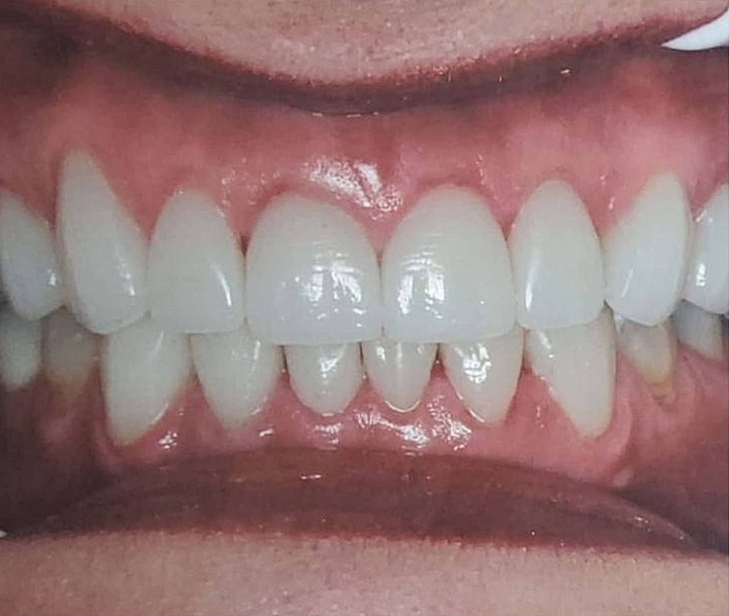 Before & Afters Before & After