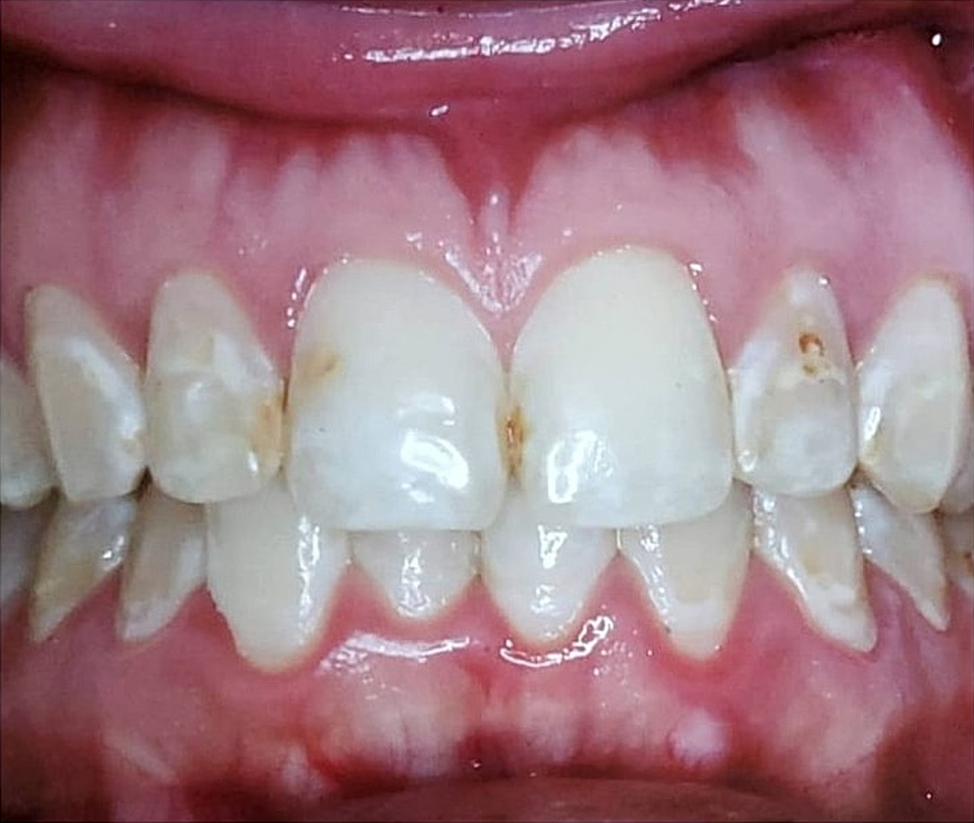 Before & Afters Before & After