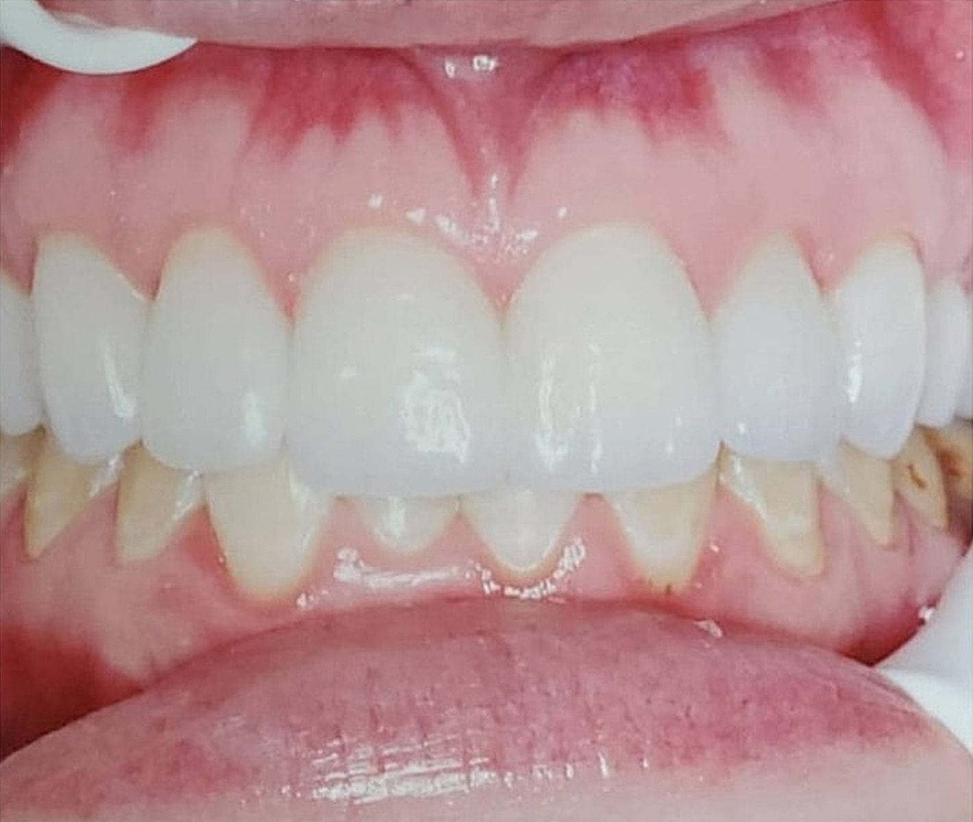 Before & Afters Before & After