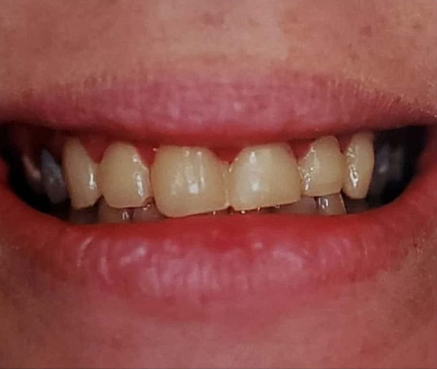 Before & Afters Before & After