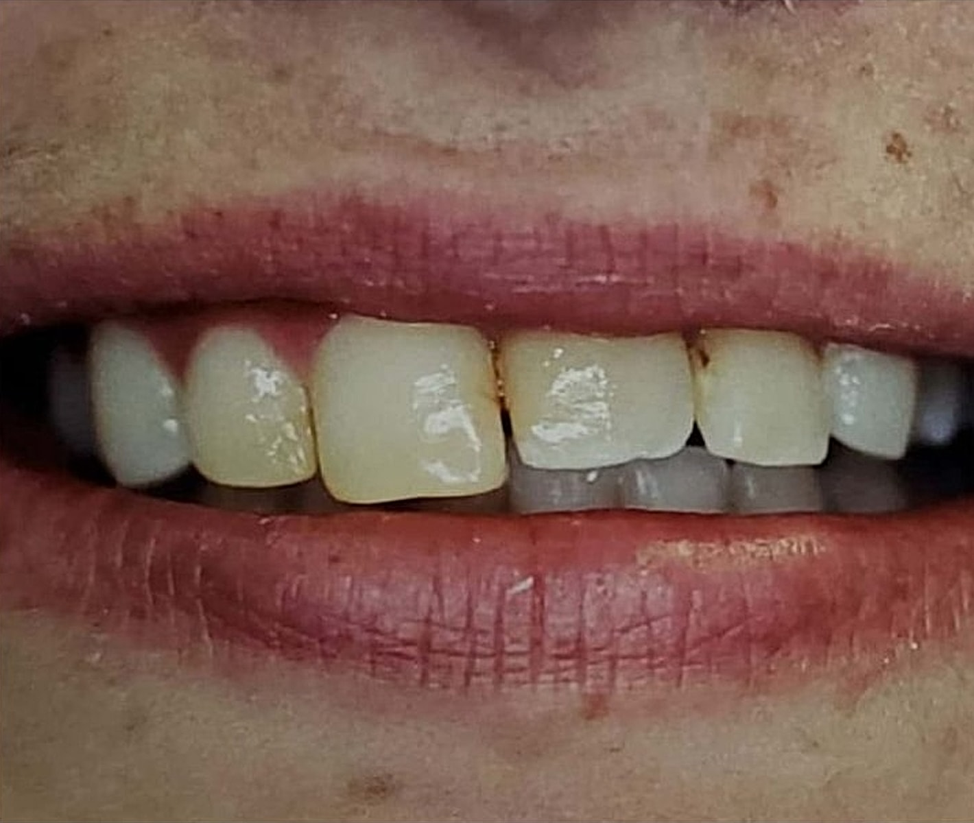Before & Afters Before & After