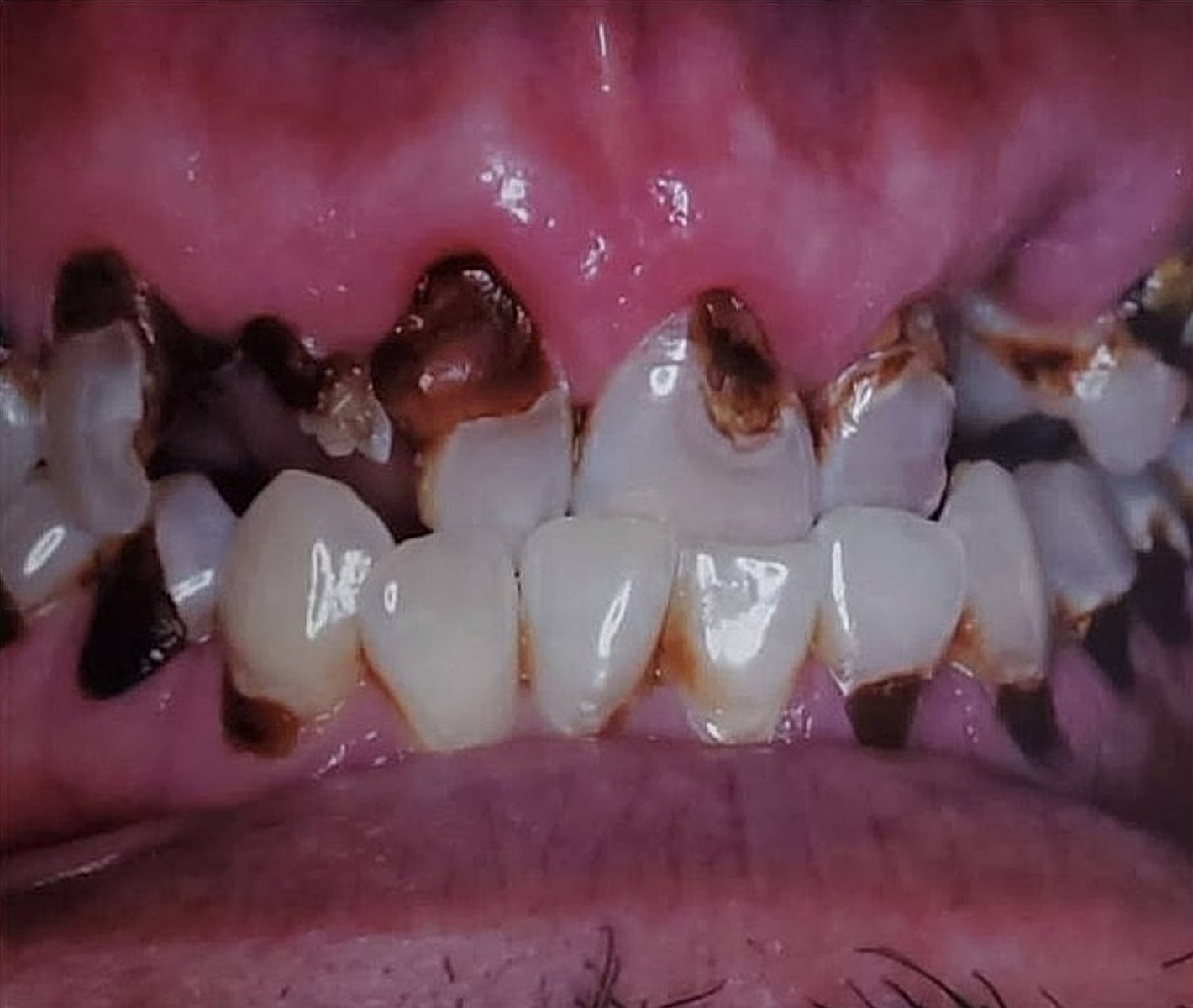 Before & Afters Before & After