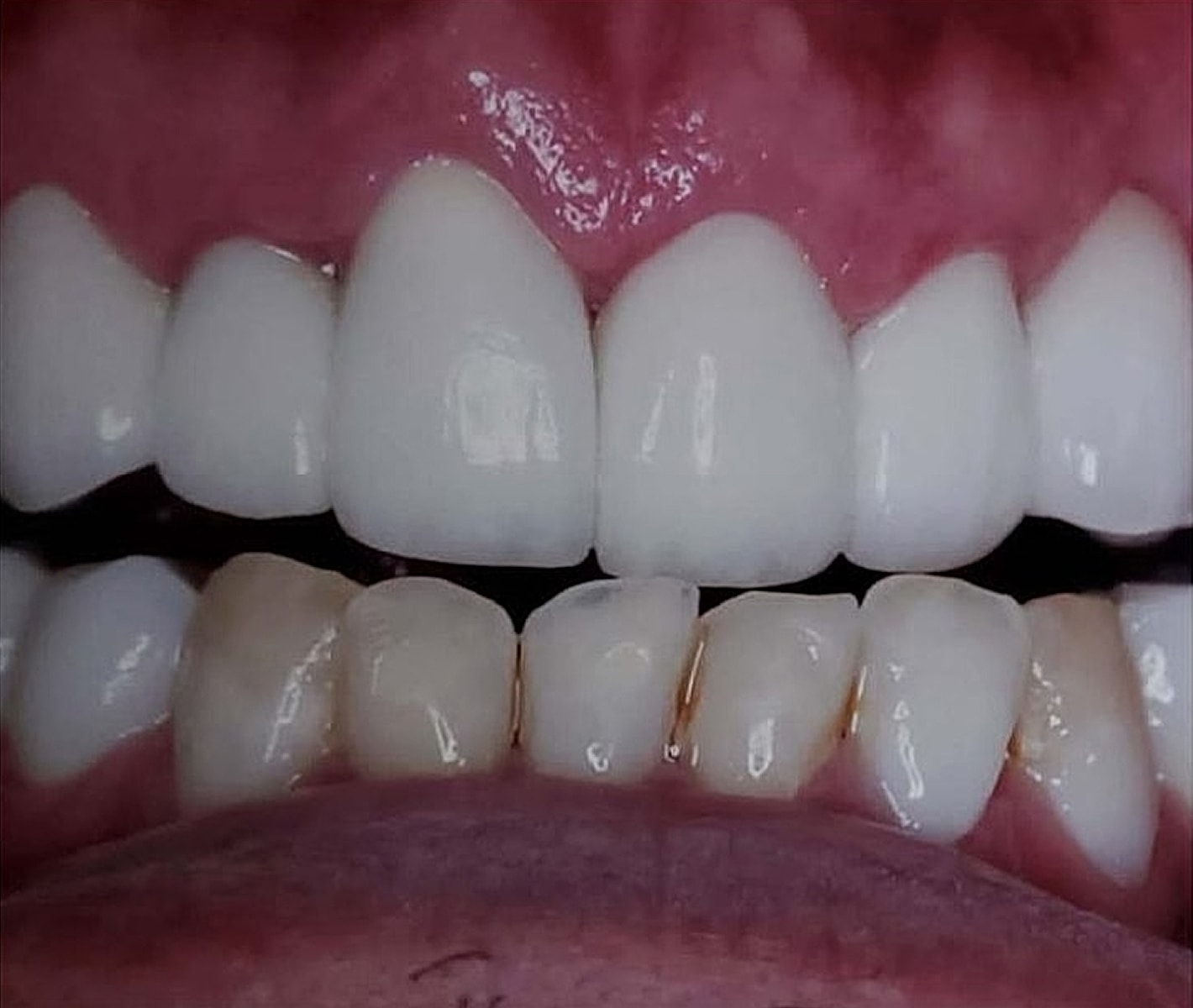 Before & Afters Before & After