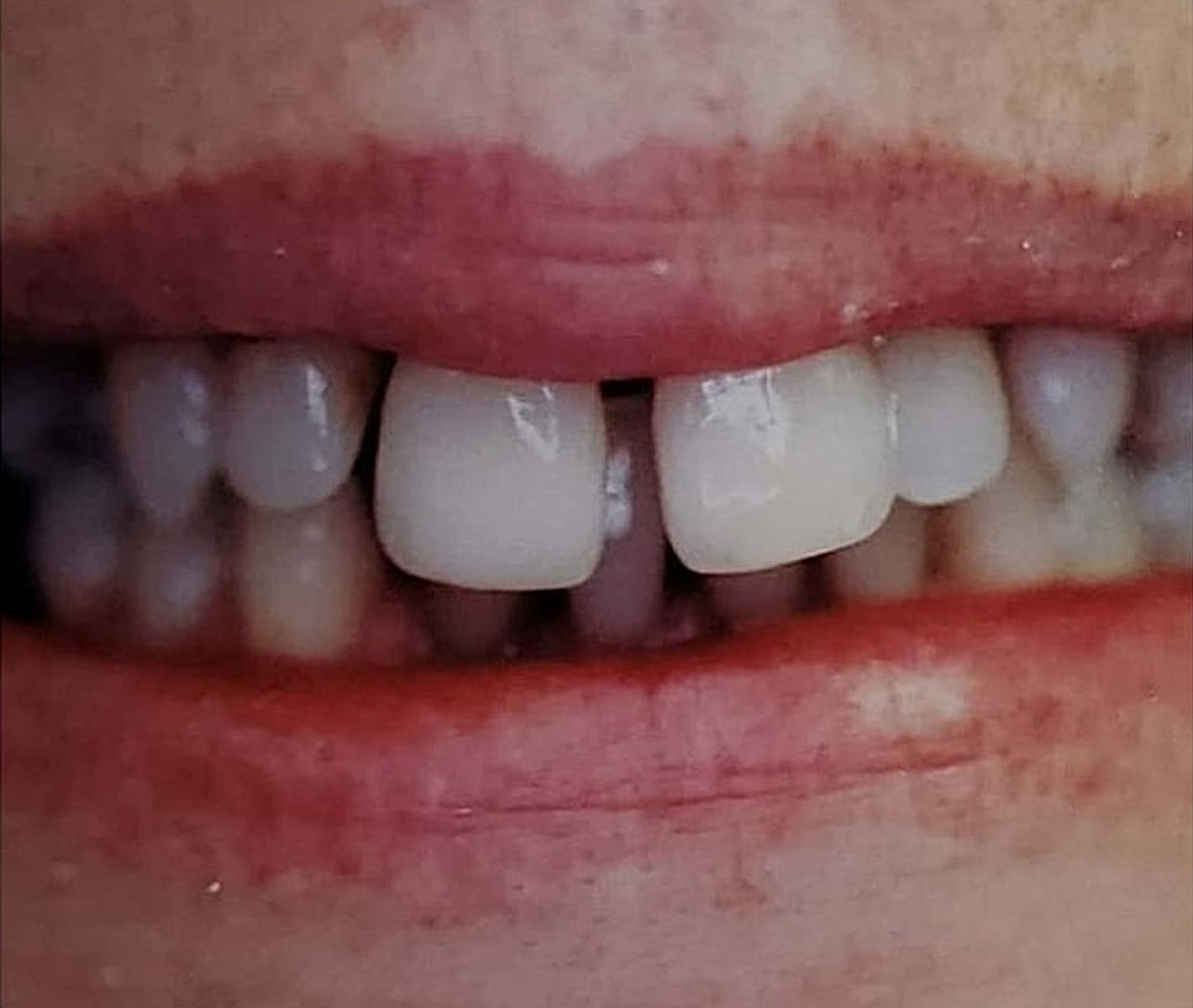 Before & Afters Before & After