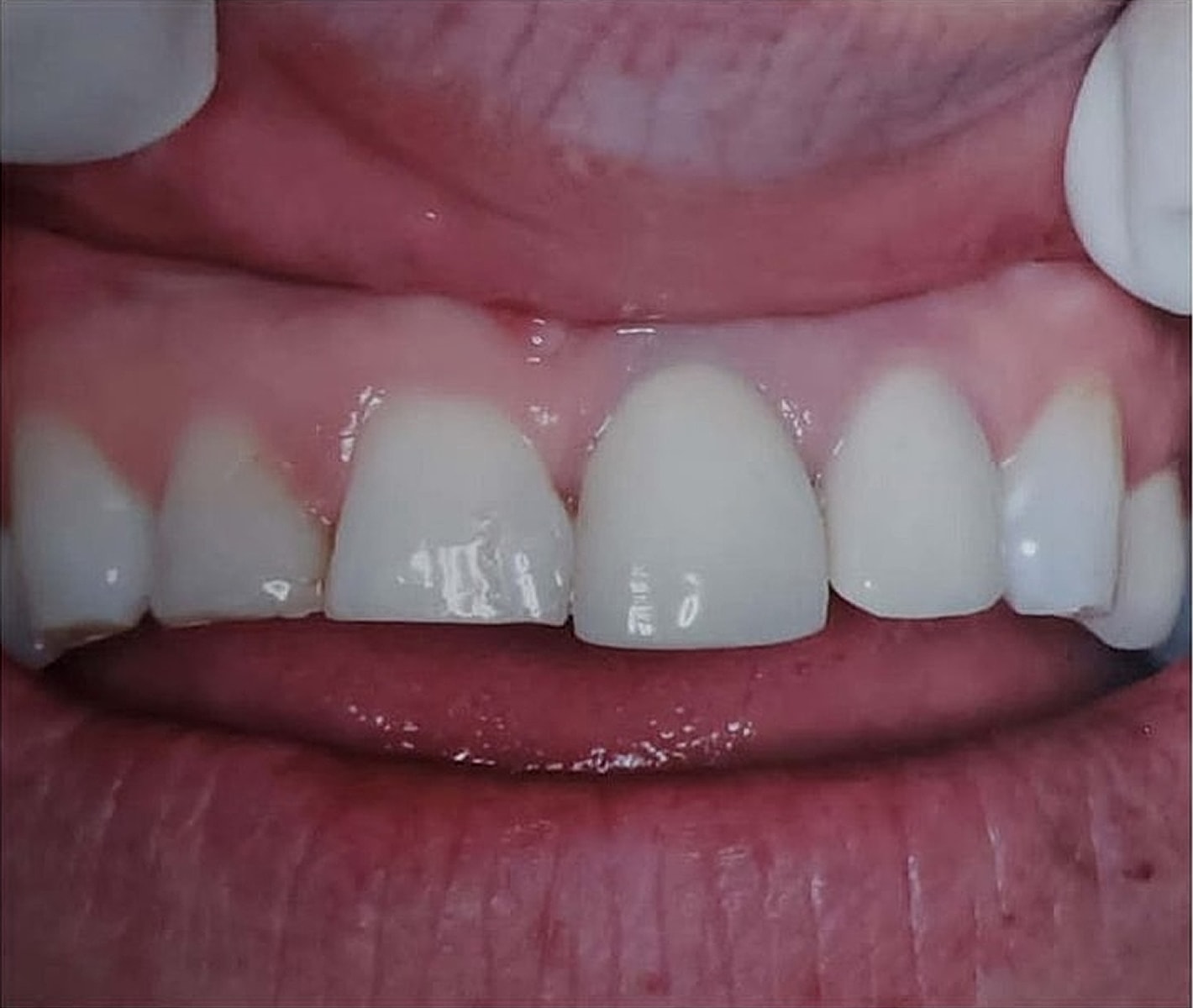 Before & Afters Before & After