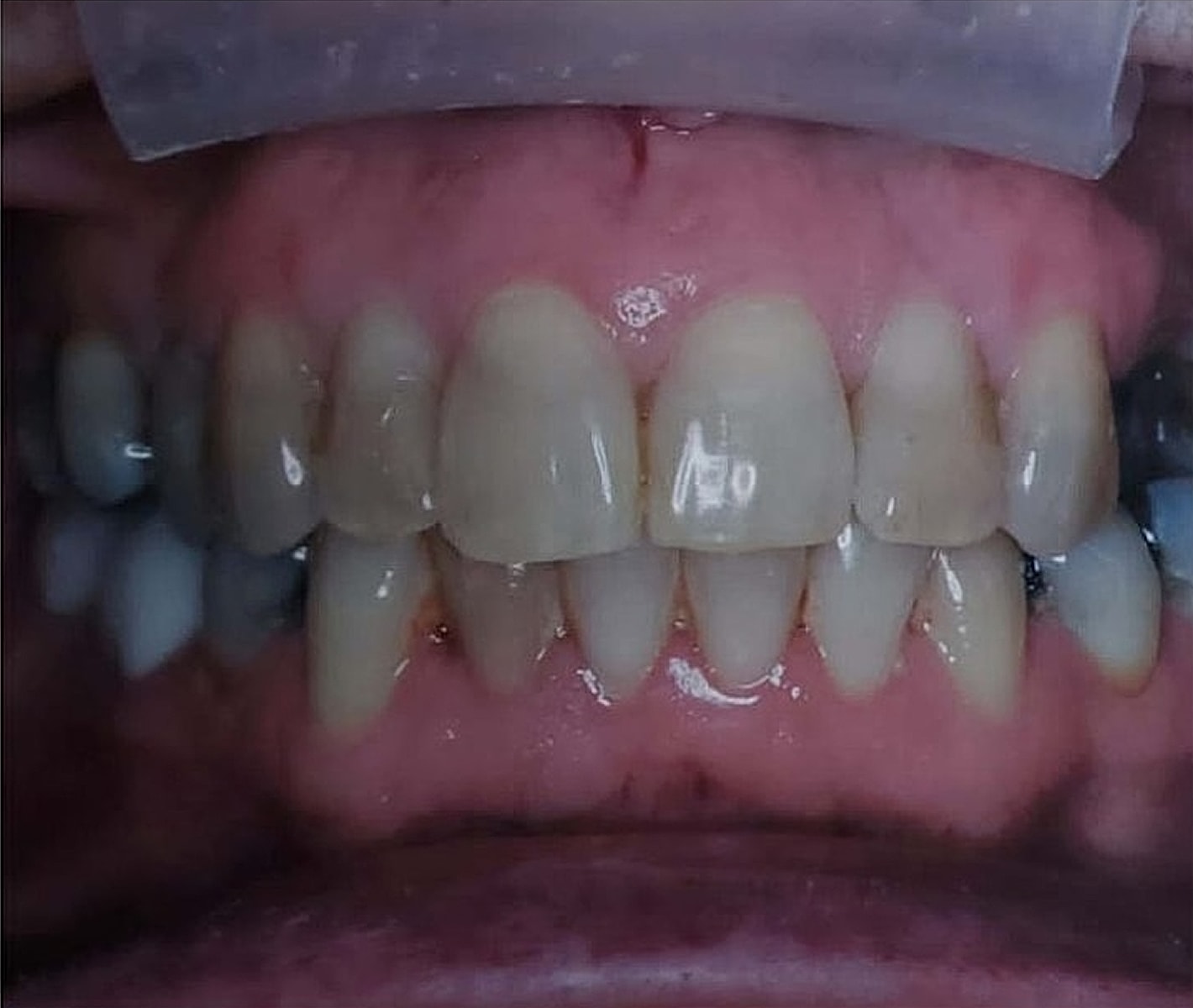 Before & Afters Before & After