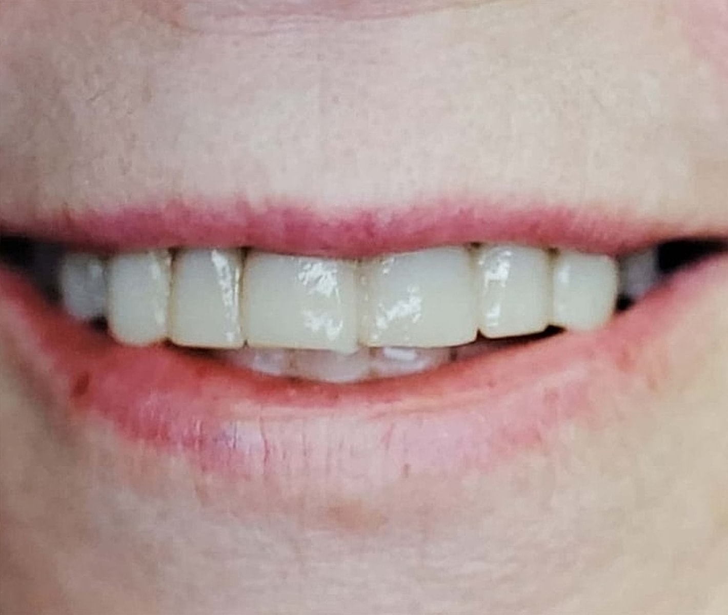Before & Afters Before & After