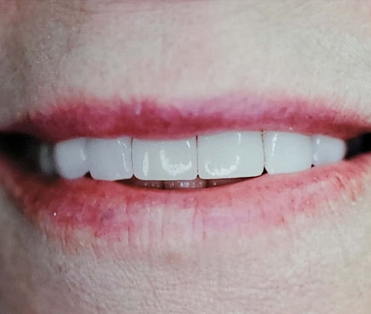 Before & Afters Before & After